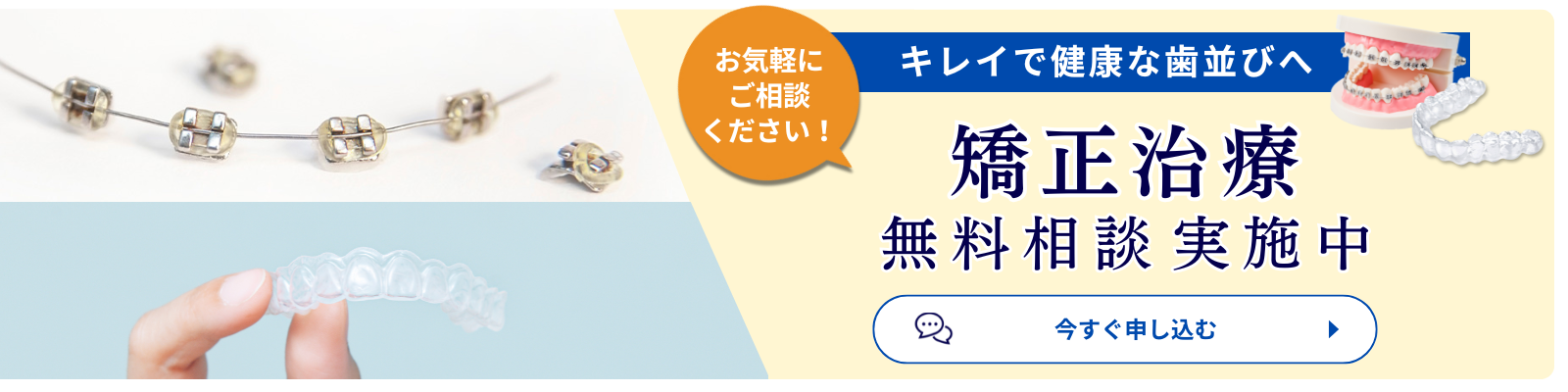 矯正無料相談実施中